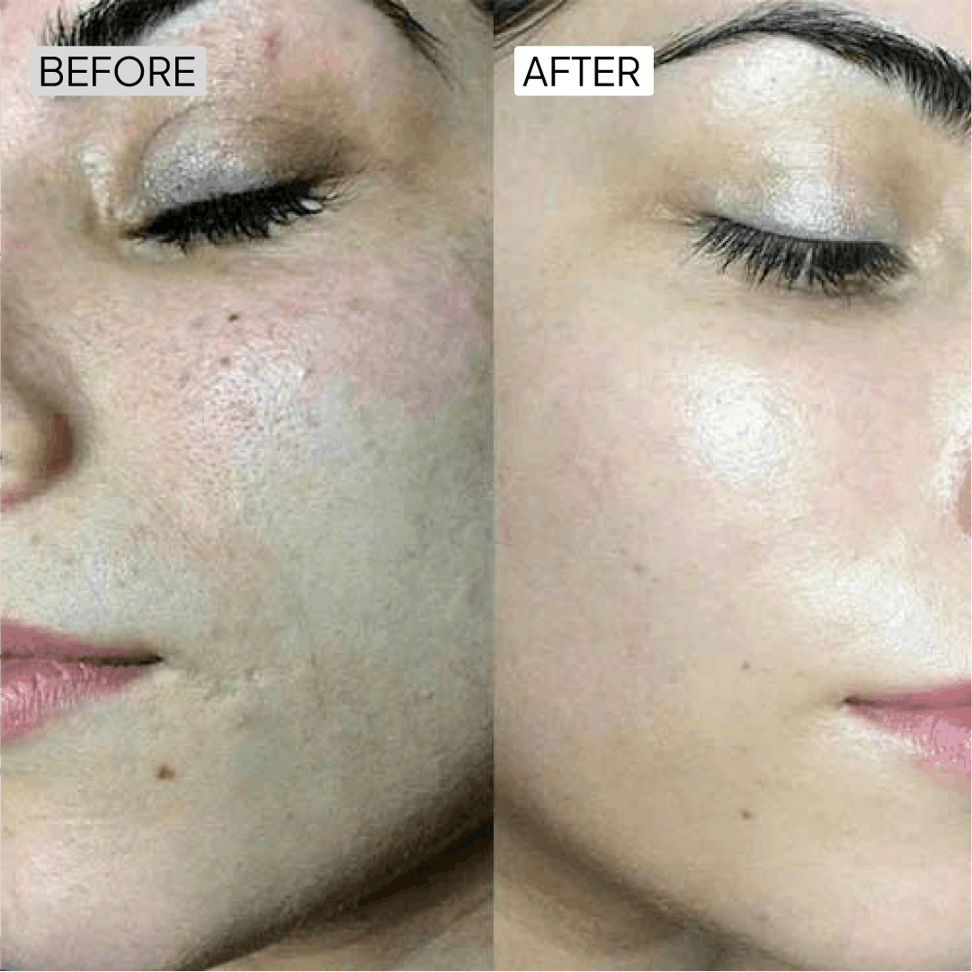 Before After