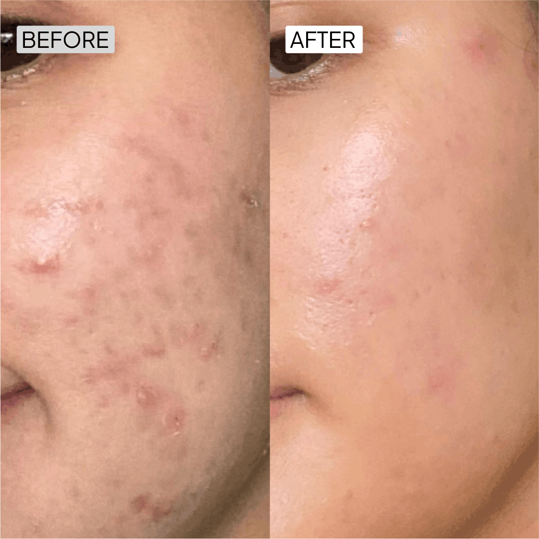 Before After