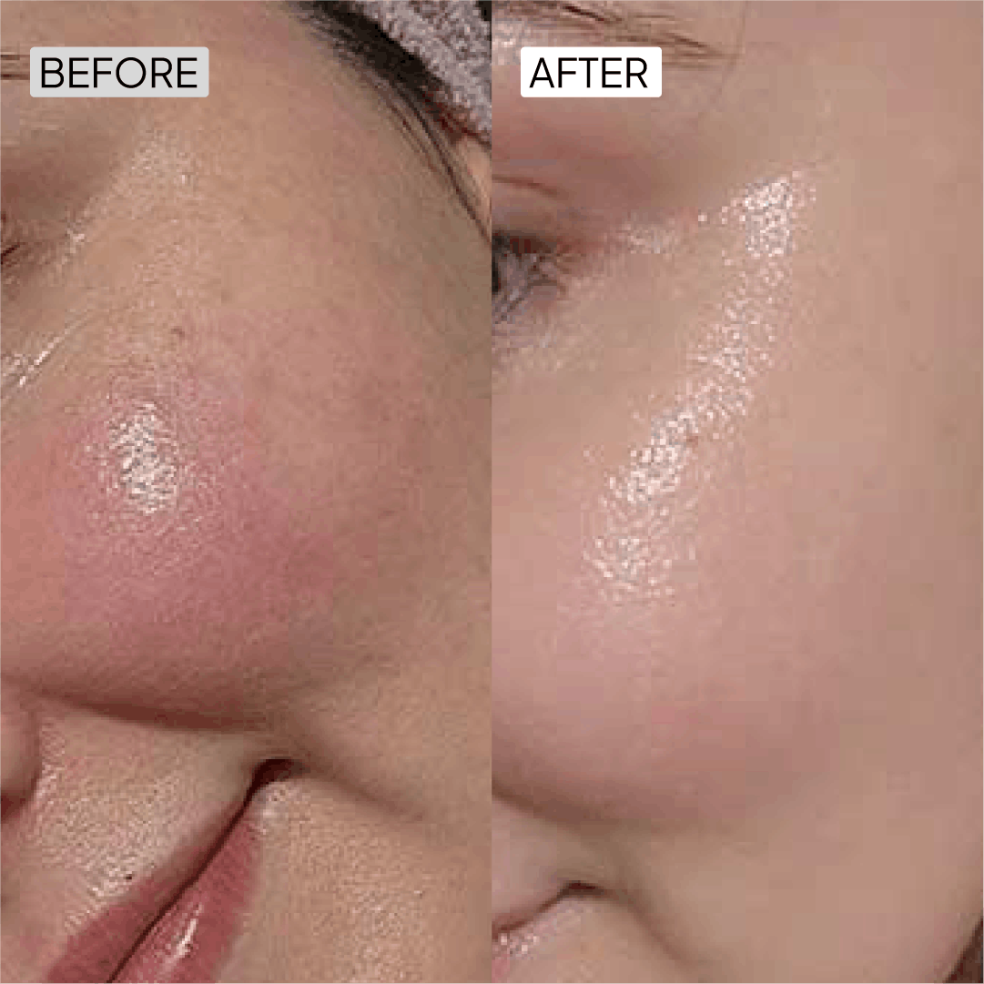 Before After