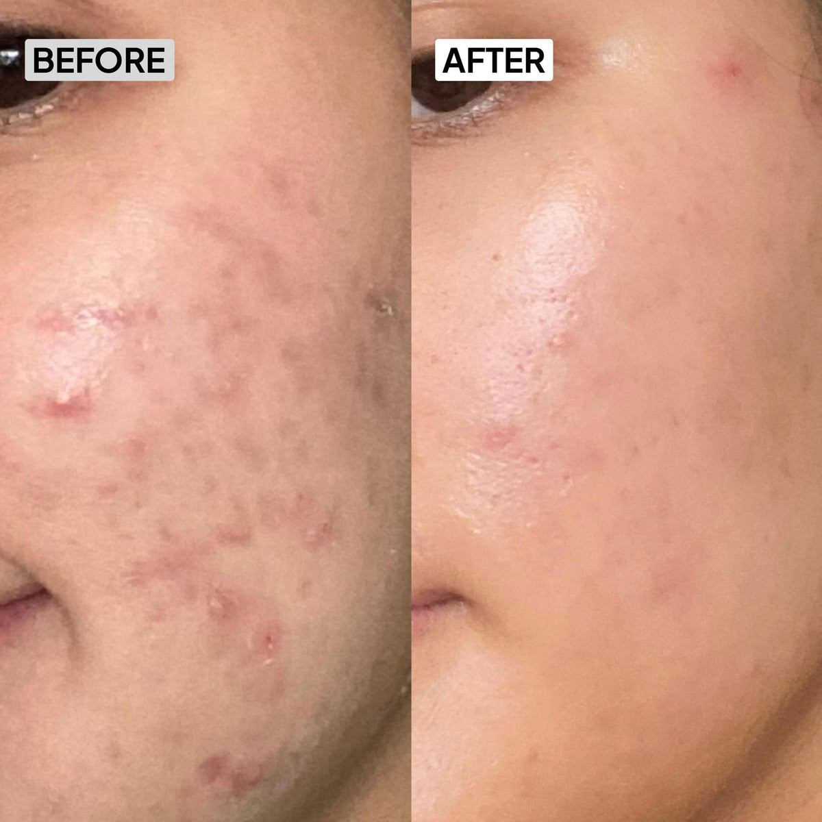 Before After