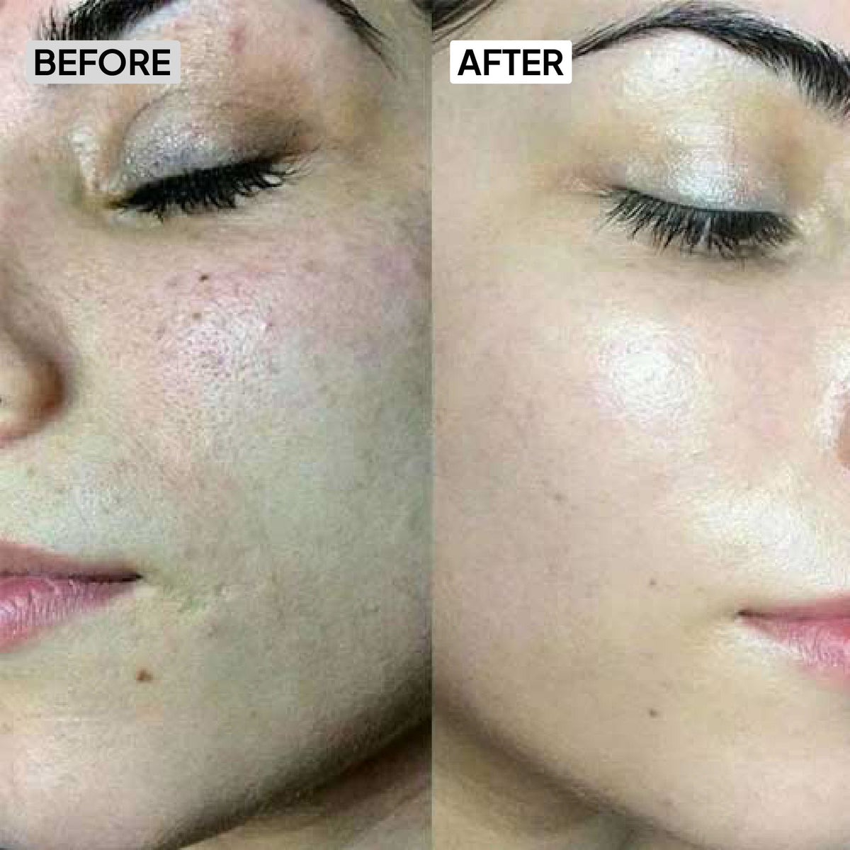 Before After