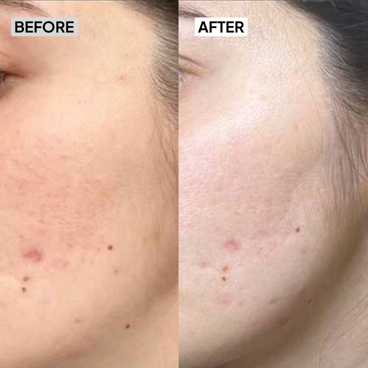 Before After