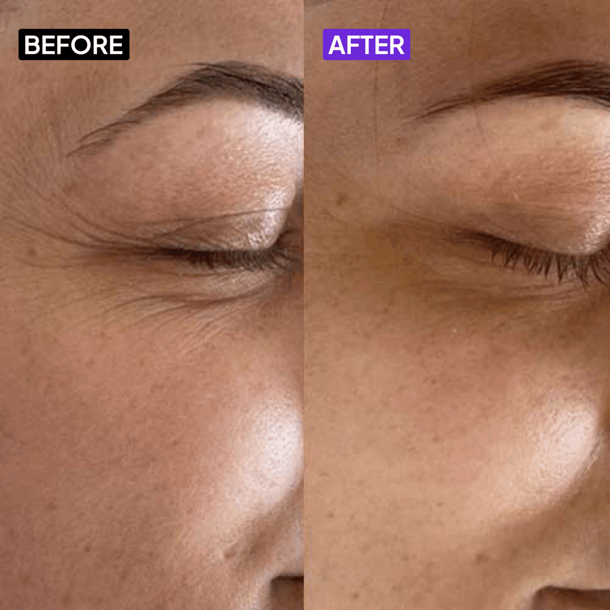 0.5% Retinol Serum - Simplist