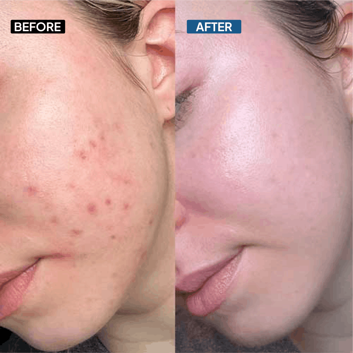 10% Niacinamide Serum - Simplist