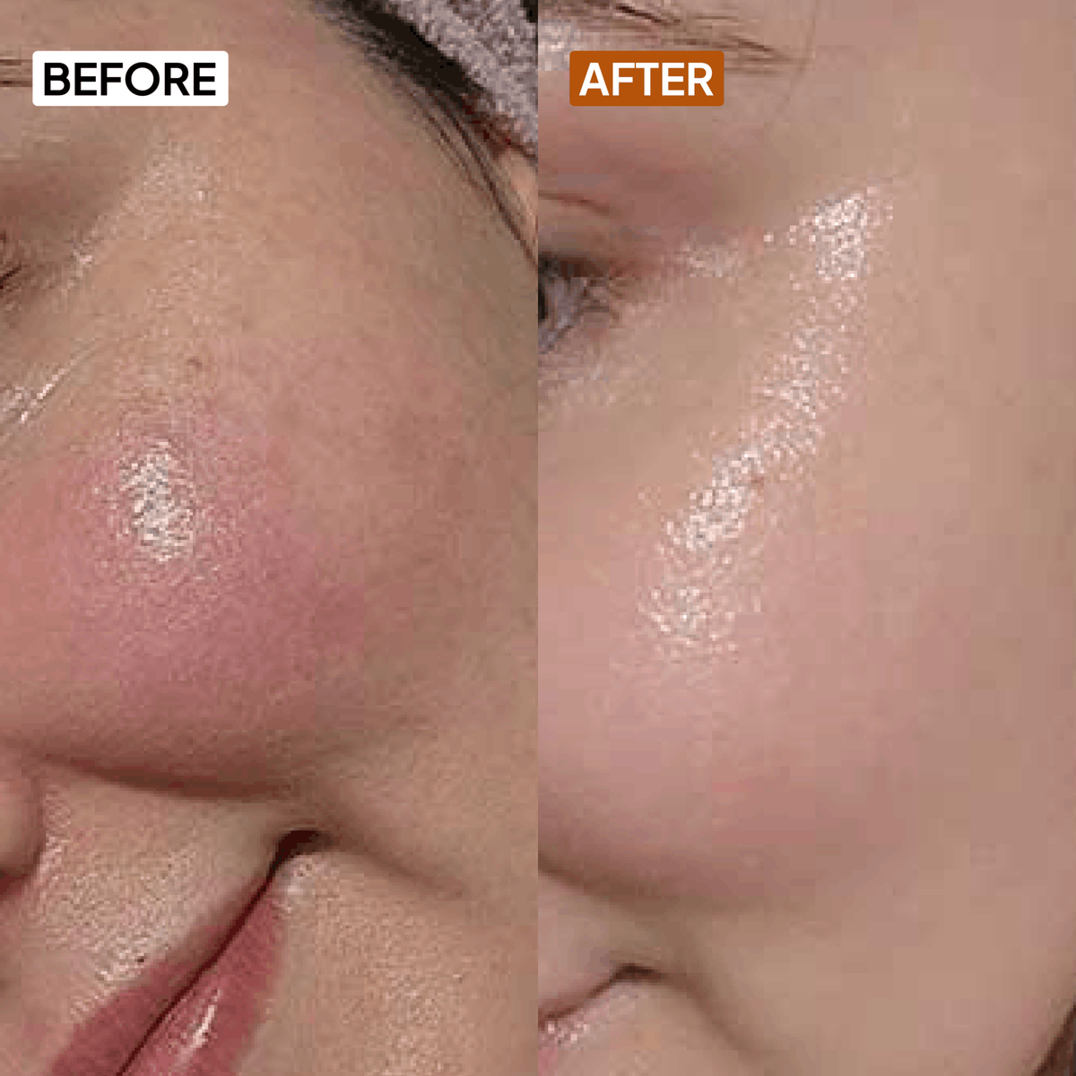 10% Vitamin C Serum - Simplist