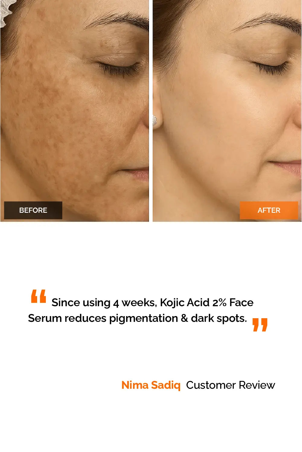 Kojic Acid 2% Face Serum Simplist