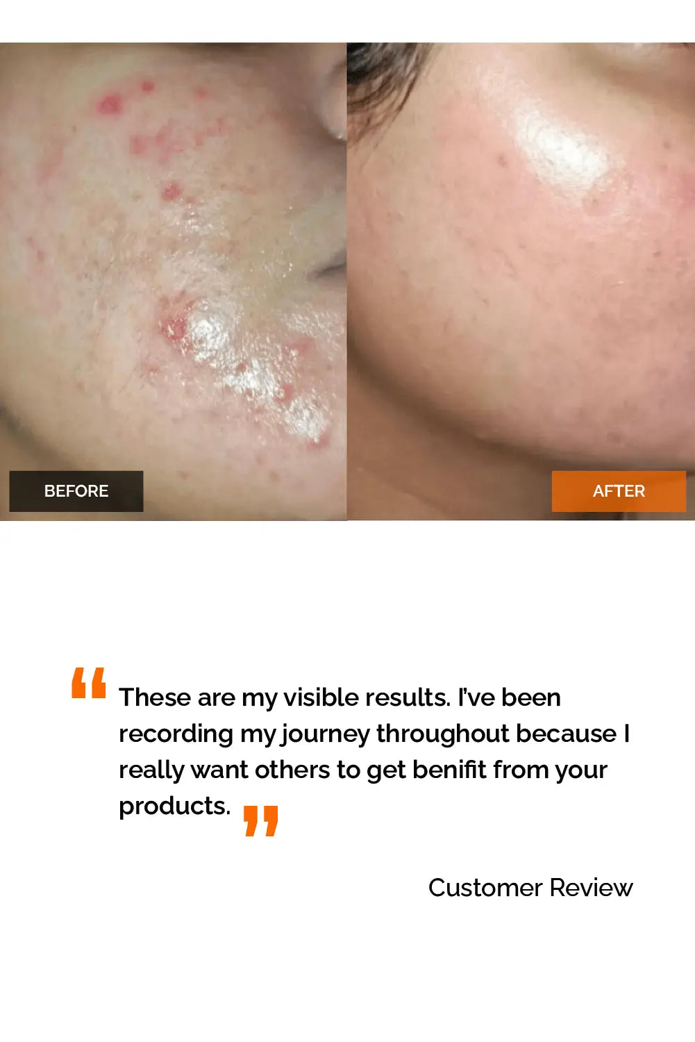 Salicylic Acid 2% Face Wash Simplist