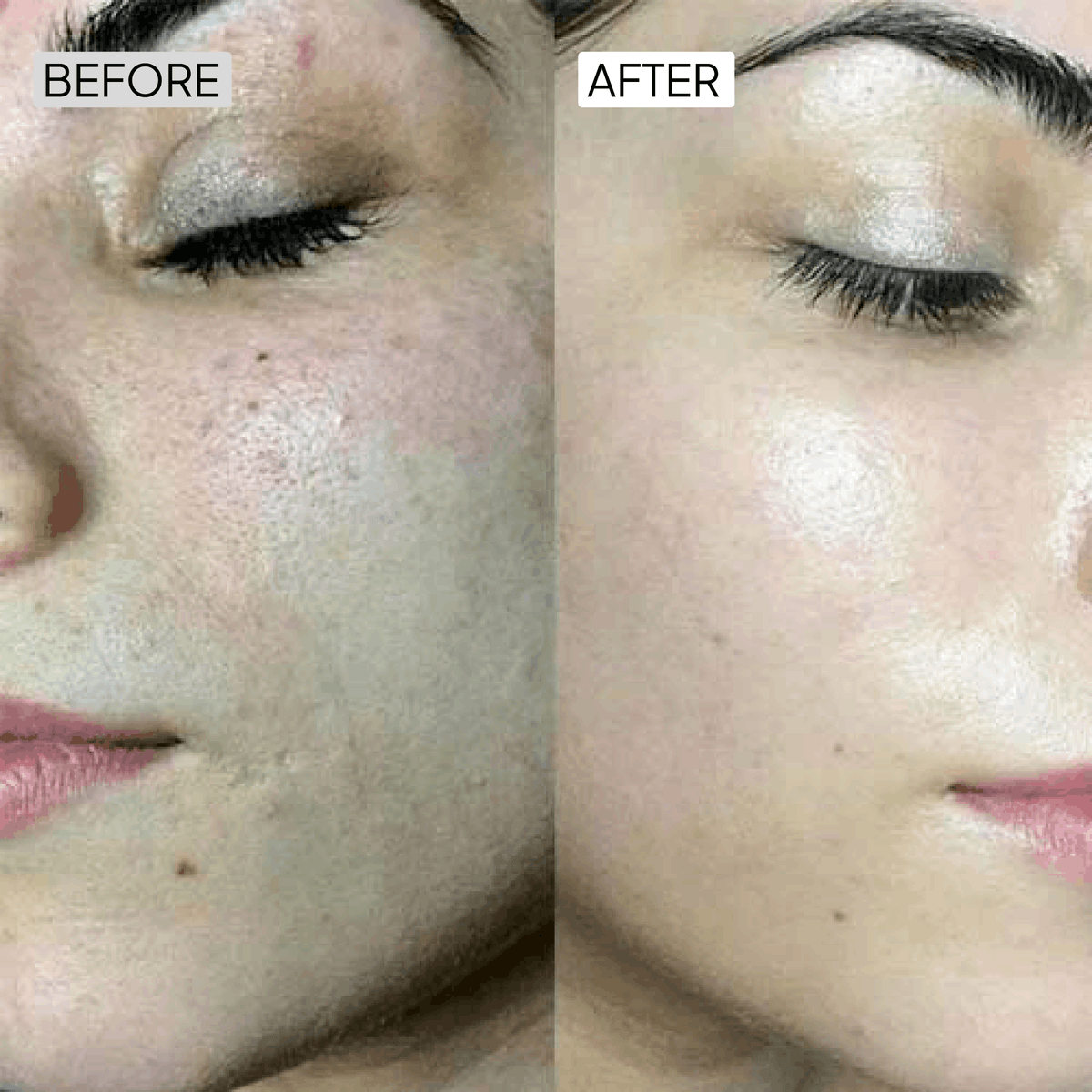 Dry Skincare Kit