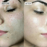 Dry Skincare Kit
