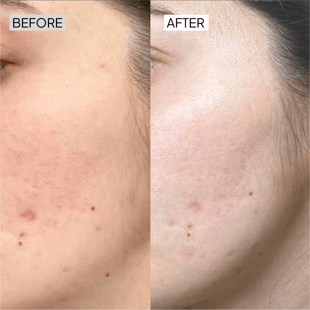 Before After