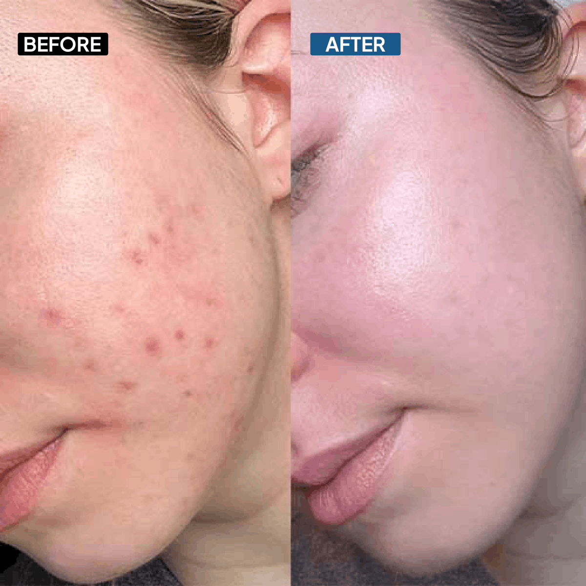 Hyaluronic Acid 2% Face Serum