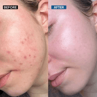 Hyaluronic Acid 2% Face Serum