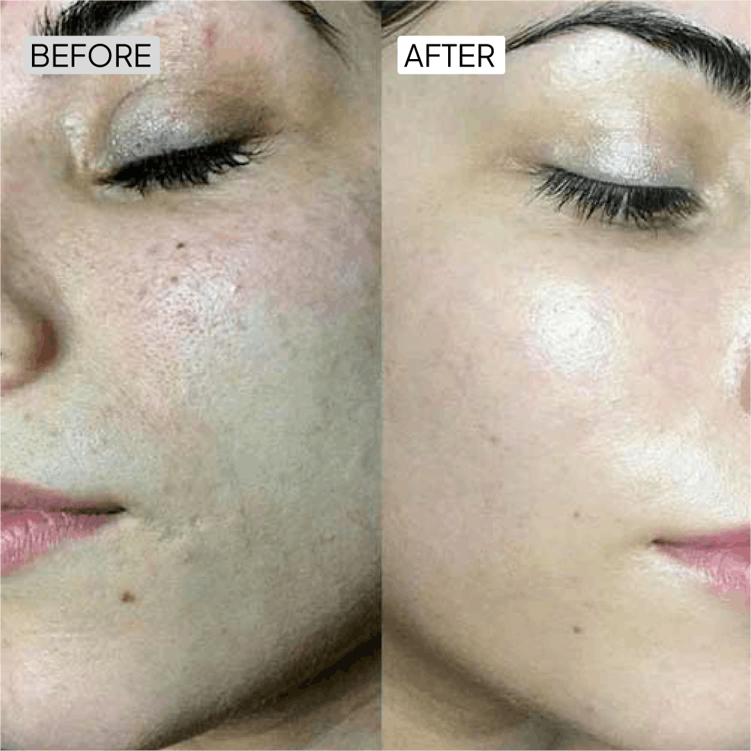 Before After