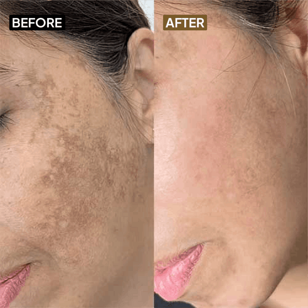 Kojic Acid 2% Gel Cleanser