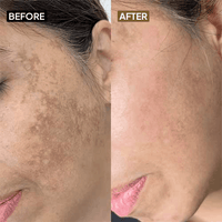 Kojic Acid 2% Face Cream
