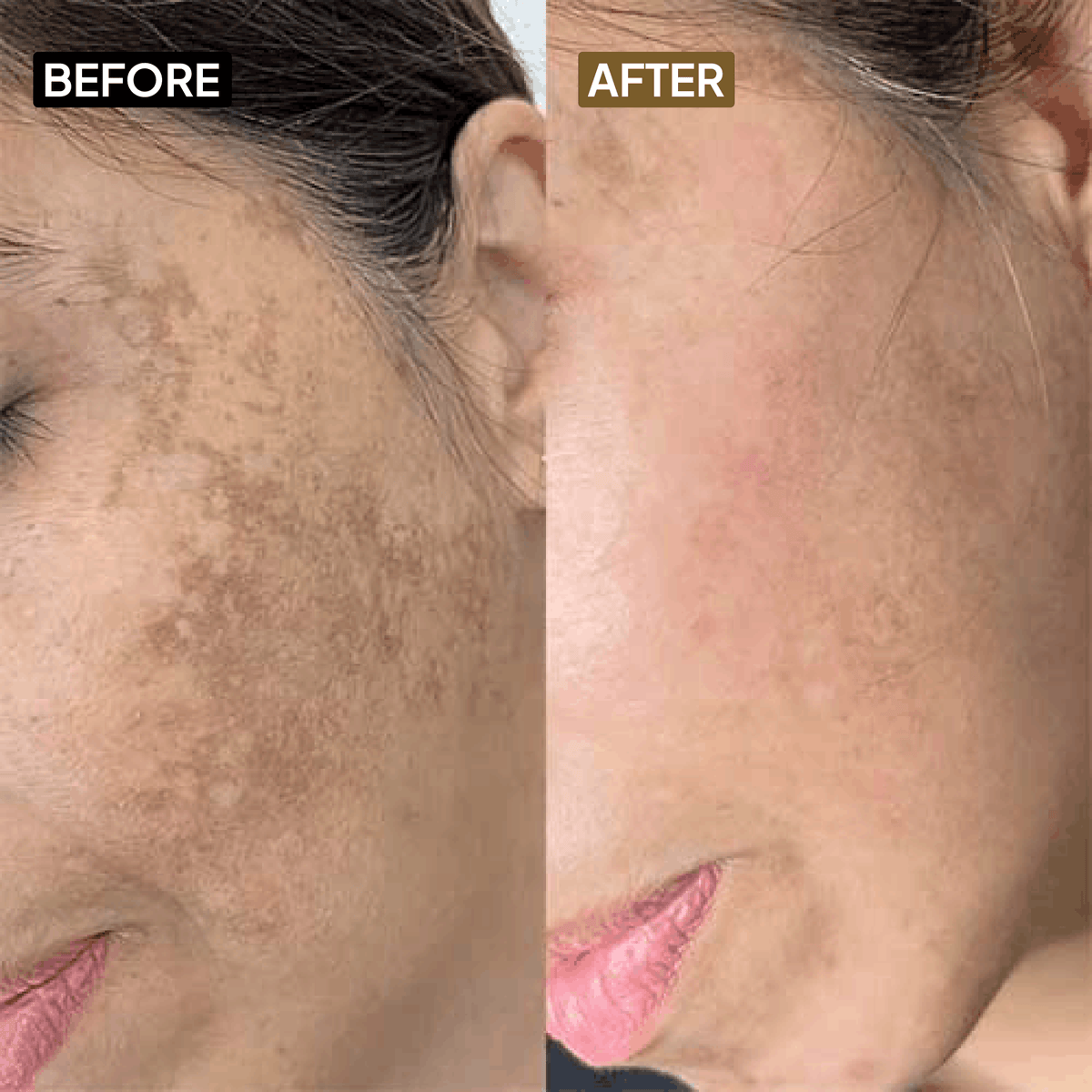 Kojic Acid 2% Face Serum