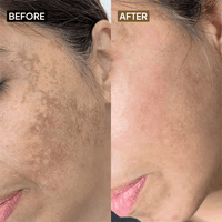 Kojic Acid 2% Face Serum