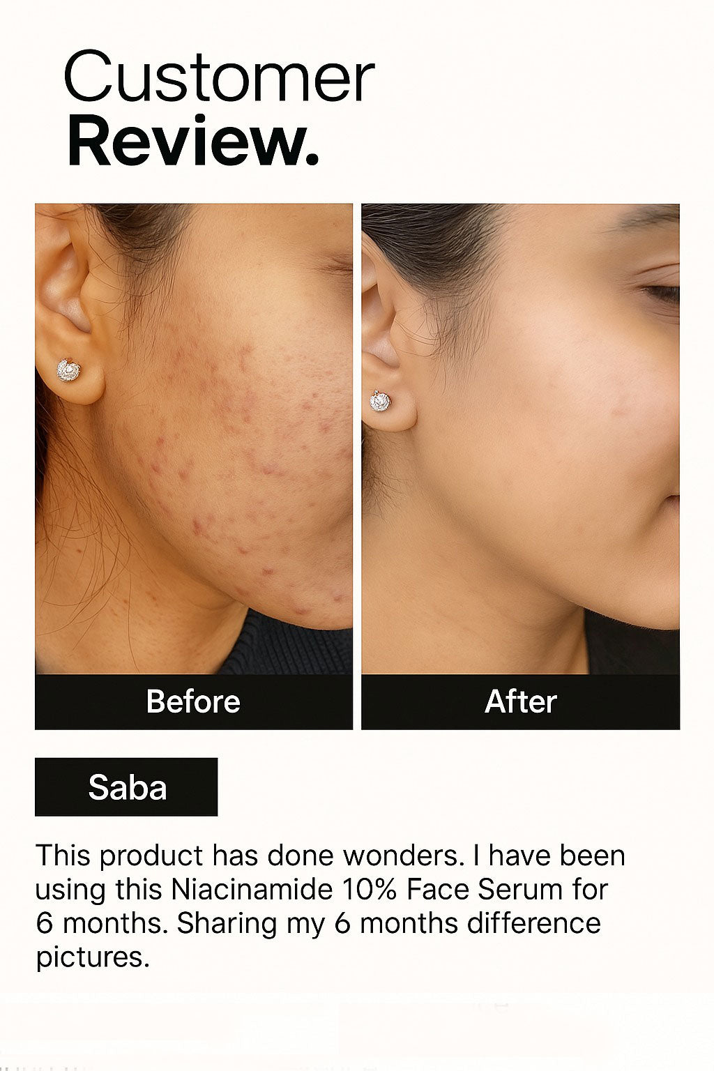 Niacinamide Face 10% Serum before after