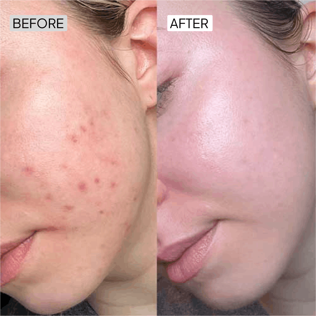 Before After