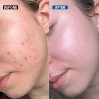 10% Niacinamide Serum