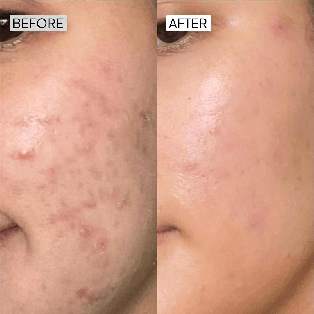 Before After