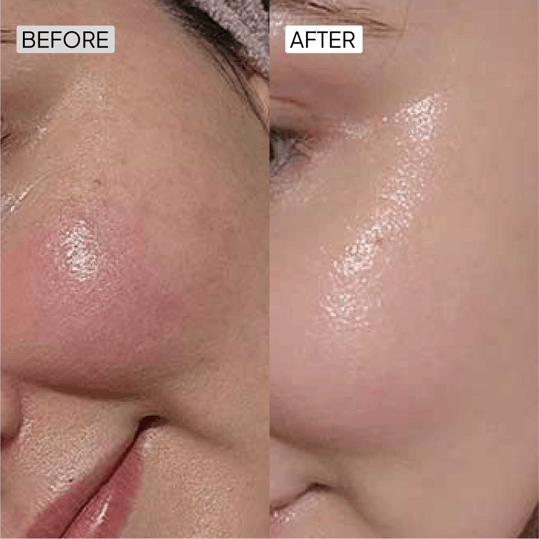 Before After