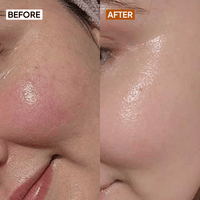 Vitamin C 10% Face Serum