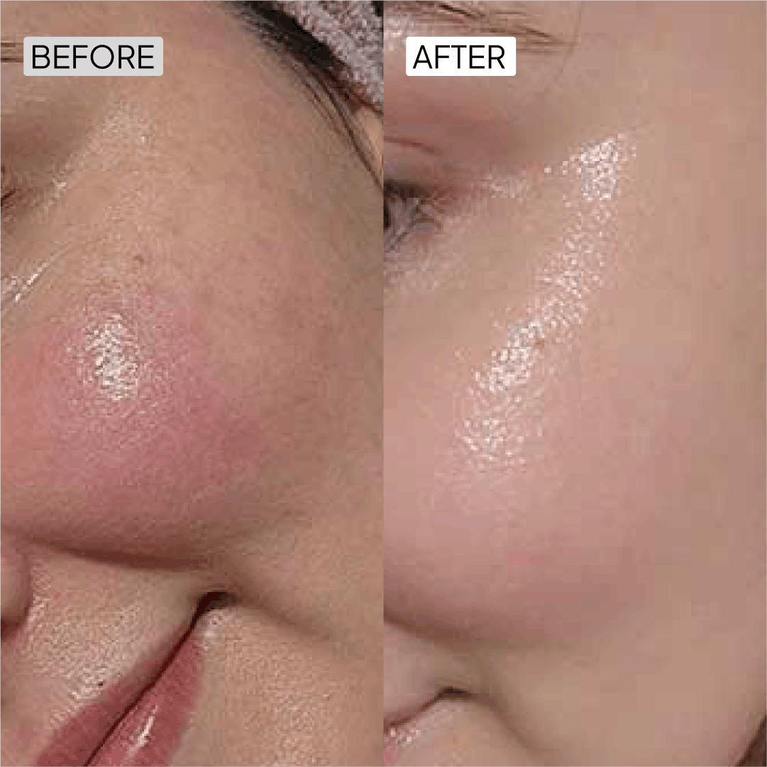 Before After