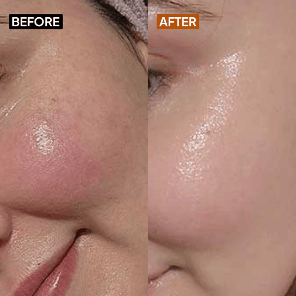 Vitamin C 10% Face Cream