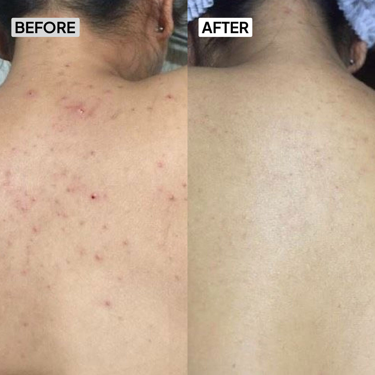 Before After