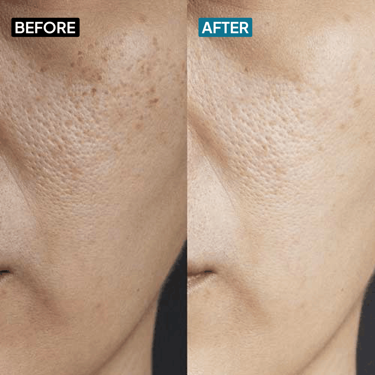 Ceramides & Hyaluronic Acid Moisturizer - Simplist