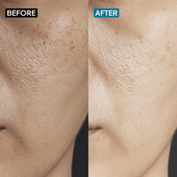 Ceramides & Hyaluronic Acid Moisturizer - Simplist