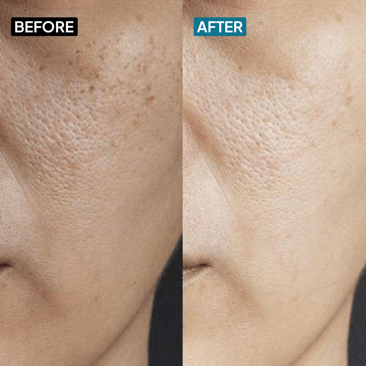 Ceramides & Hyaluronic Acid Moisturizer - Combo - Simplist