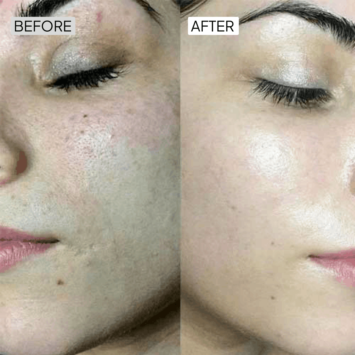 Dry Skincare Kit - Simplist