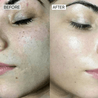 Dry Skincare Kit - Simplist