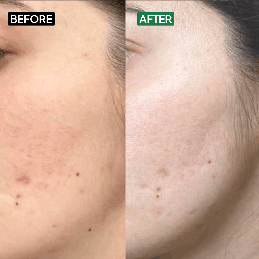 Glycolic Acid 7% Toner