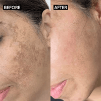 Kojic Acid 2% Gel Cleanser - Simplist
