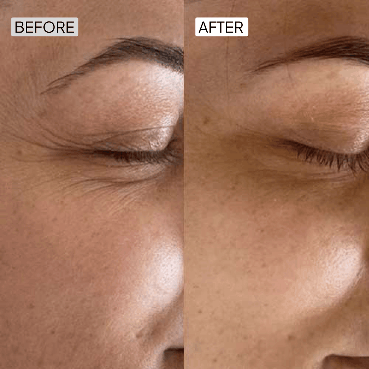 Retinol Anti Aging Kit - Simplist