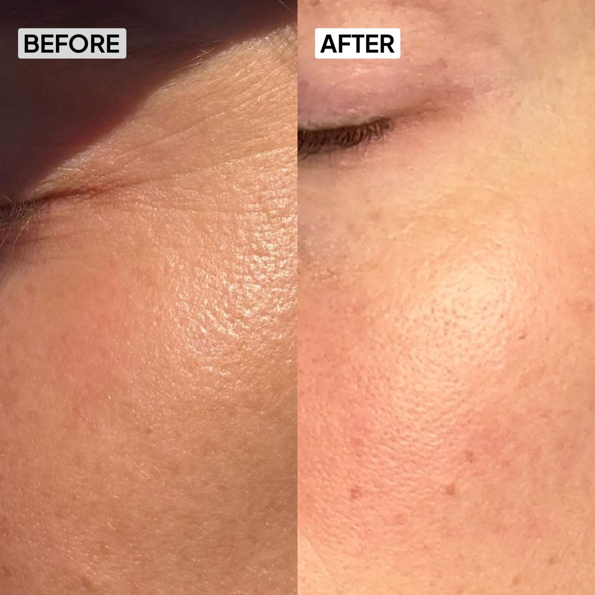 SPF 50 Sunscreen - Combo - Simplist