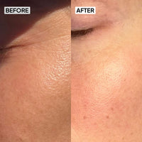 SPF 50 Sunscreen - Combo - Simplist