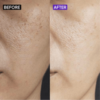 Vitamin B5 10% Moisturizer - Simplist