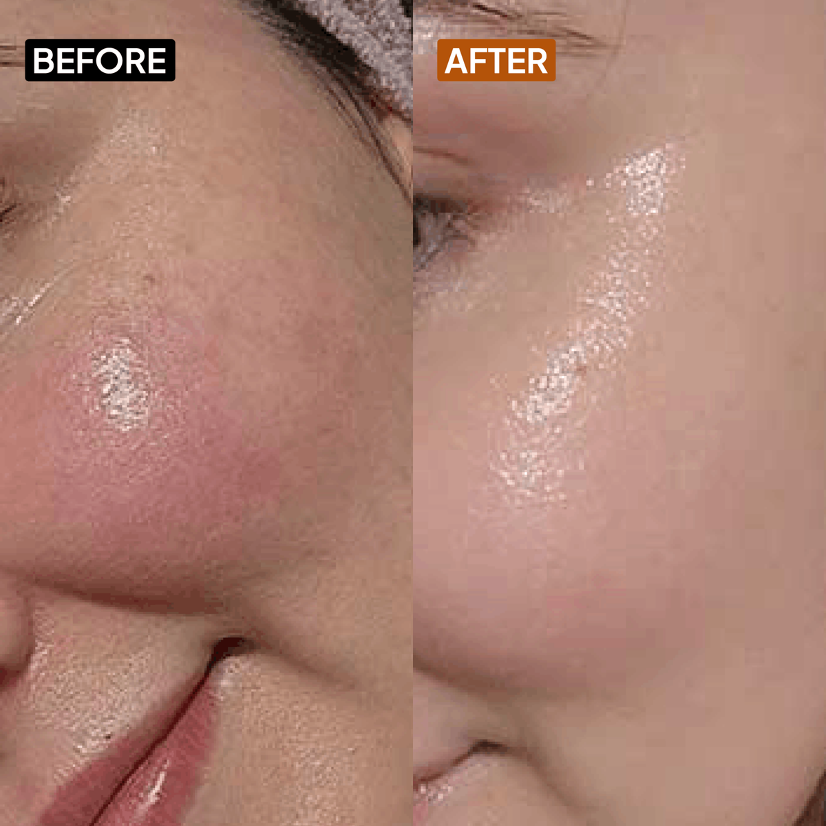 Vitamin C 10% Face Cream - Simplist
