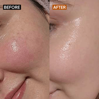 Vitamin C 10% Face Cream - Simplist