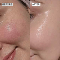 Vitamin C Skin Brightening Kit - Simplist
